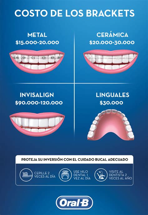 costo de los brackets metalicos en mexico|precio de los brackets en Mexico.